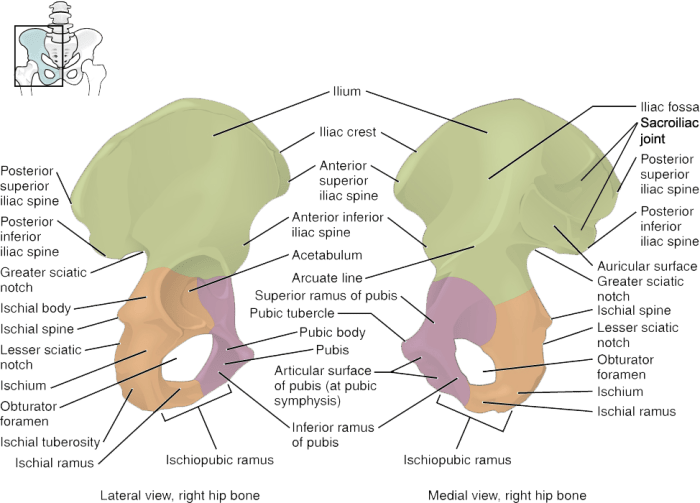 Bone lateral pelvic coxal fracture avulsion pelvis wikem acetabular fractures