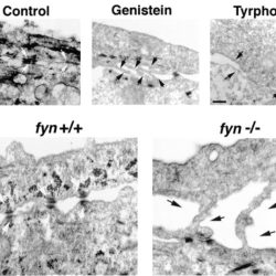 Keratinocyte cycle desmosomes life