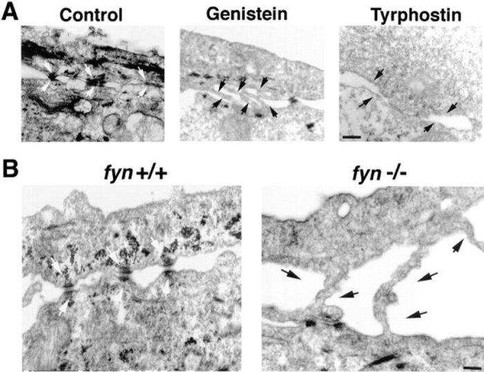 Keratinocyte cycle desmosomes life